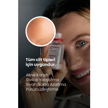 Akne Karşıtı Losyon 30ml – Akne Yatıştırıcı, Siyah Nokta Fiyatı