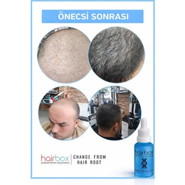 HAİRBOX Erkek Saç Serum, Mini Saç Serum Seti ( 1 Serum, 1 Fiyatı