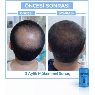 HAİRBOX Erkek Saç Serum, Mini Saç Serum Seti ( 1 Serum, 1 Fiyatı