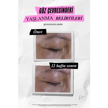 Kiehl's Super Multi Corrective Göz Kremi 14 ml Koyu Halka Fiyatı