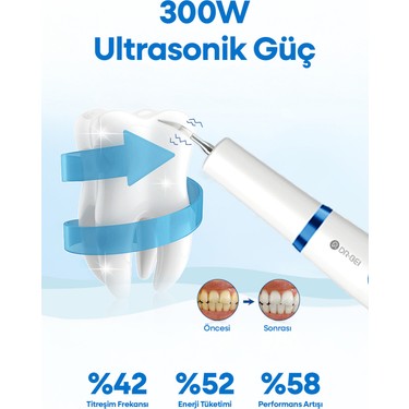 Dr.Bei GYC2 Şarjlı Ultrasonik Diş Taşı Temizleme Cihazı 3 Fiyatı