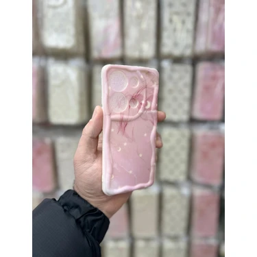 Doescase Xiaomi Redmi Note 13 Pro Uyumlu Desenli Darbe Önleyici Pinterest