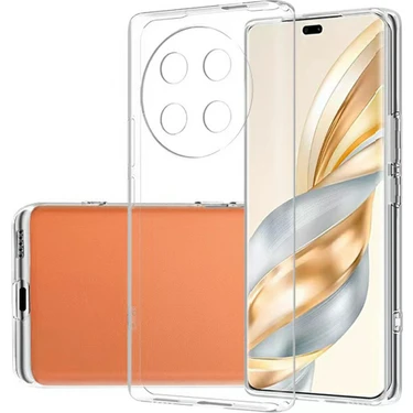 Xshine Honor Magic7 Lite 5g Şeffaf Telefon Kılıfı Esnek Tpu Arka Kapak (Yurt