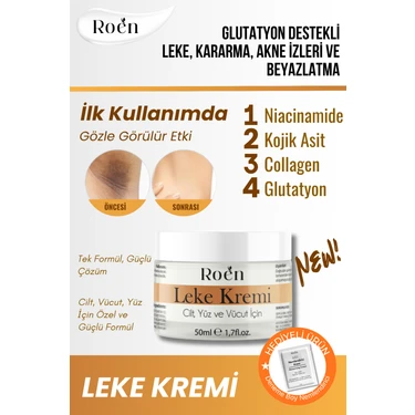 Roen Cilt Beyazlatıcı, Leke Kremi, Kararma, Akne,  Glutatyonlu Beyazlatıcı Leke Krem
