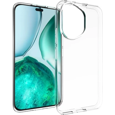 Xshine Honor 400 5g Şeffaf Telefon Kılıfı Filigran Dayanıklı Tpu Arka Kapak (Yurt