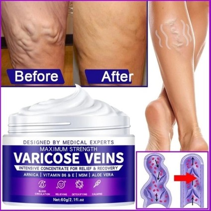 Maximum Strength Varicose Veins Krem 100 ml 1 Adt fiyatları
