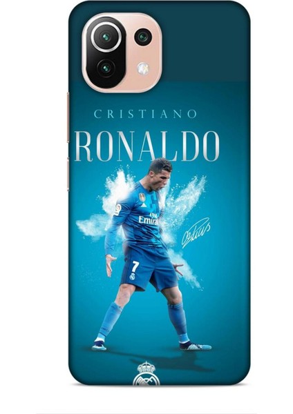 Xiaomi 11 Lite 5g Riksos Futbolcular 11 Cristiano Ronaldo Mavi 4K Baskılı Kılıf