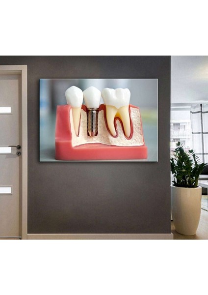 Ağız ve Diş Polikliniği, Dişçi Tabloları Dekoratif Diş, Dekoratif Dişçi, Dişçi Dekorasyonu DSC187