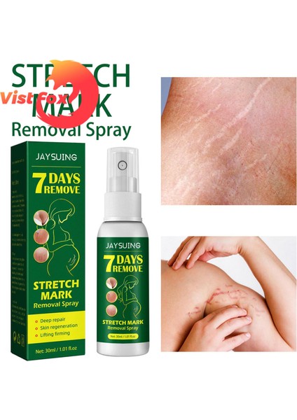 Vist Fox Çatlak Giderici Uzun Ömürlü Çatlak Giderici Sprey (Yurt Dışından) indirimleri