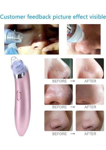 Güzellik Cihazı Gözenek Temizleyici Siyah Nokta Ingilizce Sürüm Temizleme Cihazları Gül Altın Şarj Edilebilir (Yurt Dışından) modelleri