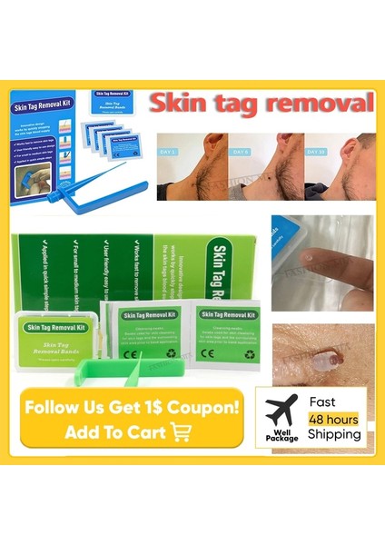 Papilloma Temizleme Aracı Küçük ve Orta Yüz Bakımı Için Mavi Mikro Bant Cilt Etiketi Sökücü Kit Mısır Temizleme Swabları ile Köstebek Wartkit ve 30 Adet Bant (Kit ve 30 Adet Bant) (Yurt Dışından) fiyatları