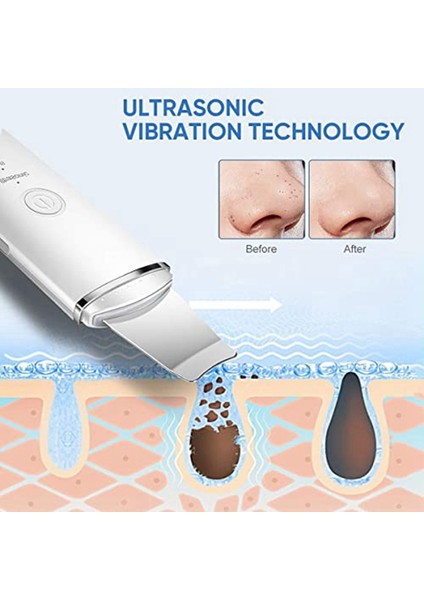 4 Modlu Profesyonel Cilt Spatula Siyah Nokta Temizleyici, Kadınlar ve Erkekler Için Yüz Gözenek Derin Temizleyici Cilt Bakım Aracı (Yurt Dışından) fırsatları