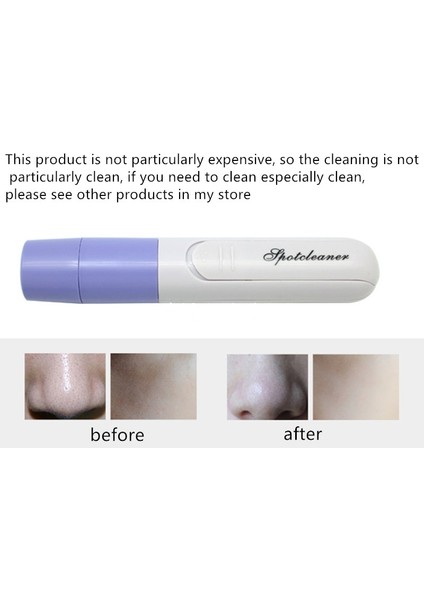 Elektrikli Siyah Nokta Giderici Yüz Gözenek Temizleyici Cilt Yüz Kir Emmek Vakum Akne Sivilce Sökücü (Pil Dahil Değildir) Güzellik (Yurt Dışından) indirimleri