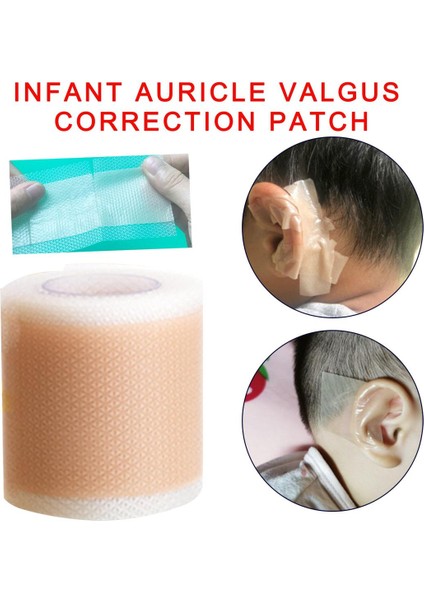 Yeni Kulak Düzeltme Bandı Kulak Temizleyici Araç Kiti Yenidoğan Bebek Kulak Estetik Düzelticiler Çocuklar Bebek Çıkıntılı Kulak Yama Çıkartmalar (Yurt Dışından)