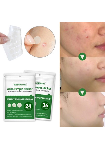 Doğal Malzemeler Akne Sivilce Etiket Hidrokolloid Yama Yüz Akne Sökücü Tedavisi Leke Nokta Cilt Bakımı Güzellik Araçları Yeni (Yurt Dışından)