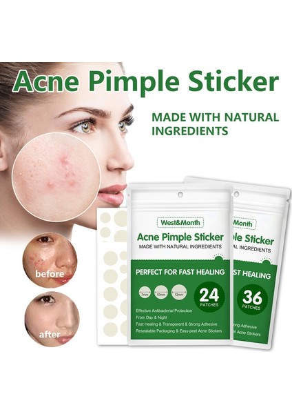 Doğal Malzemeler Akne Sivilce Etiket Hidrokolloid Yama Yüz Akne Sökücü Tedavisi Leke Nokta Cilt Bakımı Güzellik Araçları Yeni (Yurt Dışından) fiyatları