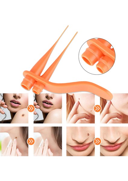 Trendygirl Cilt Etiketi Aracı Hızlı Etkili Papilloma Temizleme Küçük Yüz Bakımı Mısır Temizleme Aracı (Yurt Dışından)