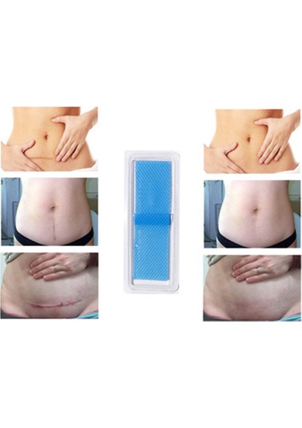 Skar Onarım Güzellik Yaması (Tek Parça) Akne Travma Skar Cilt Onarımı Için 3.5*5cm - Mavi 3.5*12CM (Yurt Dışından) fırsatları