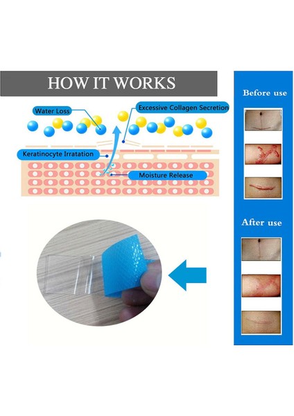 Skar Onarım Güzellik Yaması (Tek Parça) Akne Travma Skar Cilt Onarımı Için 3.5*5cm - Mavi 3.5*12CM (Yurt Dışından) indirimleri