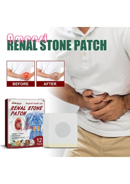 Ameesi Vücut Iyileştirici Yama Akupunktur Noktası Sağlık Böbrek Taş Yamasını Absorbe Etmek Kolay (Yurt Dışından) fırsatları