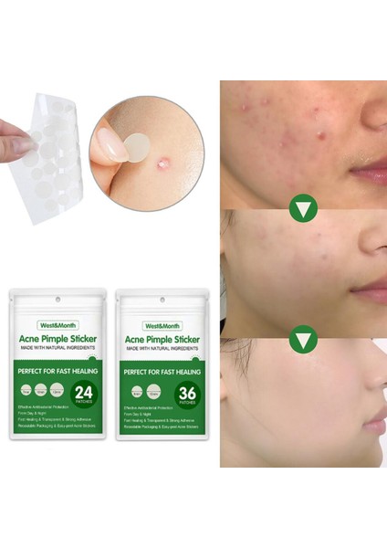 24/36 Adet Yamalar Güzellik Akne Araçları Sivilce Yama Seti Cilt Etiketi Sökücü Sivilce Ana Hidrokolloid Yama Yüz Cilt Bakımı (Yurt Dışından)
