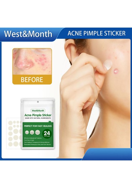 24/36 Adet Yamalar Güzellik Akne Araçları Sivilce Yama Seti Cilt Etiketi Sökücü Sivilce Ana Hidrokolloid Yama Yüz Cilt Bakımı (Yurt Dışından) fiyatları