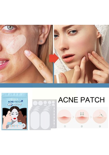 36 Adet/takım Hidrokolloid Akne Görünmez Sivilce Ana Etiketi Sökücüler Yama Sivilce Cilt Yüz Kaldırma Leke Bakımı/siyah Nokta P G3Z8 (Yurt Dışından) modelleri