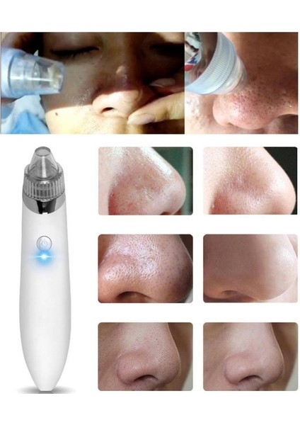 Güzellik Cihazı Gözenek Temizleyici Siyah Nokta Ingilizce Sürüm Temizleme Cihazları Beyaz Şarj Edilebilir (Yurt Dışından) modelleri