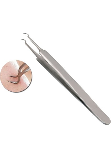 Adet Viraj Kavisli Paslanmaz Çelik Beyaz Nokta Siyah Nokta Sivilce Klipleri Sivilce Komedon Sökücü Yüz Temizleyici Iğneler Aracı (Yurt Dışından) fiyatları