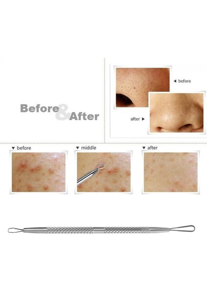 Profesyonel Paslanmaz Çelik Siyah Nokta Komedon Akne Sivilce Leke Çıkarıcı Sökücü Aracı (Yurt Dışından) modelleri