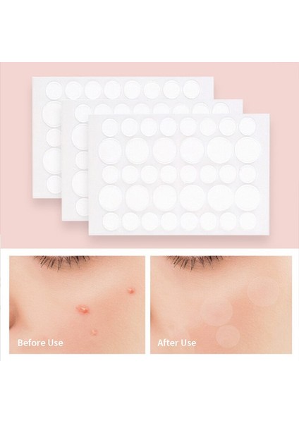 24/36 Yamalar Akne Sivilce Yama Çıkartmalar Sivilce Sökücü Aracı Irin ve Yağı Emer Akne Yama Huidverzorging Als Beschermhoes (Yurt Dışından) modelleri
