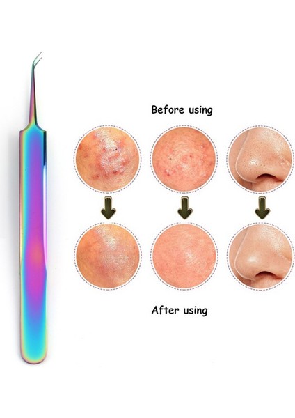 Siyah Nokta Remover Paslanmaz Iğneler Akne Komedon Sivilce Çıkarıcı Sökücü Aracı Siyah Noktalar Akne Klip Cımbız Yüz Bakım Seti (Yurt Dışından)