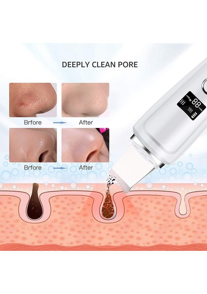 Ultrasonik Yüz Cilt Scrubber Temizleyici Yüz Masajı Cilt Bakımı Temizleyici Iyon Akne Siyah Nokta Remover Soyma Küreği (Yurt Dışından) indirimleri