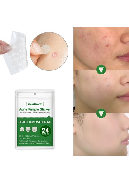 3/5/10 Takım Güzellik Akne Araçları Hidrokolloid Akne Yama Seti Cilt Etiketi Sökücü Sivilce Ana Hidrokolloid Yama Yüz Cilt Bakımı (Yurt Dışından) fiyatları