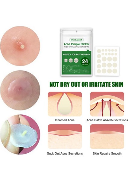 3/5/10 Takım Güzellik Akne Araçları Hidrokolloid Akne Yama Seti Cilt Etiketi Sökücü Sivilce Ana Hidrokolloid Yama Yüz Cilt Bakımı (Yurt Dışından) indirimleri