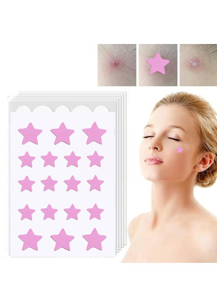 Görünmez Akne Temizleme Sivilce Yama Güzellik Akne Araçları Sivilce Kapatıcı Yüz Bakımı Skar Akne Çıkartmalar Nokta M2Q7 (Yurt Dışından) fiyatları