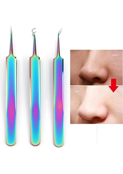 Paslanmaz Çelik Siyah Nokta Çıkarıcı Iğneler Aracı Komedon Çıkarıcı Sivilce Leke Yüz Cilt Bakımı Güzellik Araçları Akne Cımbız (Yurt Dışından)