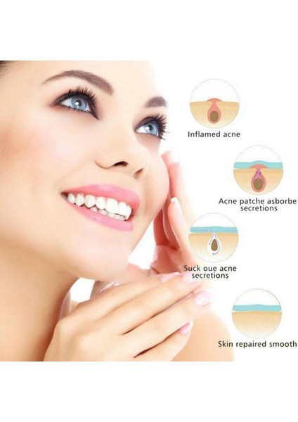 Görünmez Akne Temizleme Sivilce Yama Güzellik Akne Araçları Sivilce Akne Çıkartmalar Yüz Skar Kapatıcı Nokta Bakımı J0G1 (Yurt Dışından) fırsatları
