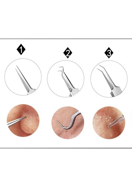 Paslanmaz Çelik Akne Cımbız Klip Siyah Nokta Kaldırma Whitehead Leke Çıkarıcı Iğne Cımbız Yüz Bakımı Güzellik Aracı (Yurt Dışından) modelleri