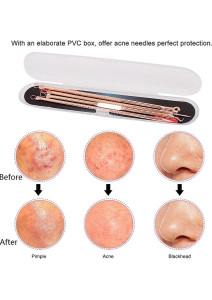 4 Adet/takım Siyah Nokta ve Sivilce Temizleme Iğneleri Akne Sökücü Siyah Kafa Gözenek Temizleyici Derin Temizlik Aracı Yüz Cilt Bakımı Araçları (Yurt Dışından) fiyatları