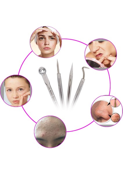 4 Adet/takım Siyah Nokta ve Sivilce Temizleme Iğneleri Akne Sökücü Siyah Kafa Gözenek Temizleyici Derin Temizlik Aracı Yüz Cilt Bakımı Araçları (Yurt Dışından) modelleri