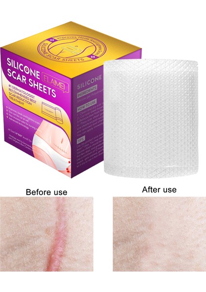 Sezaryen Skar Çıkartma Hızlı Etkili Yara Onarım Skar Çıkartma (Yurt Dışından) fırsatları