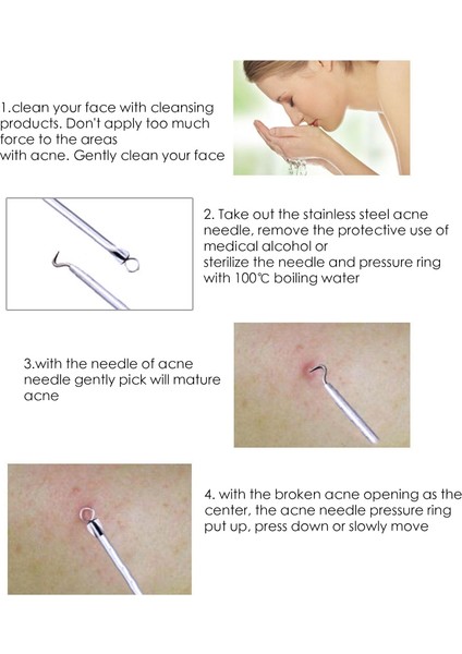 4 Adet Siyah Nokta Komedon Akne Sivilce Belmish Extractor Vakumlu Siyah Nokta Remover Aracı Kaşık Yüz Cilt Bakımı Temizleyici Aracı (Yurt Dışından)
