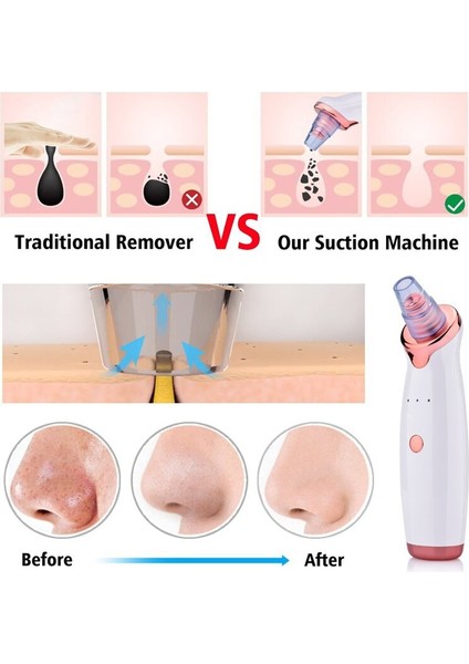 Vakumlu Siyah Nokta Remover Yüz Siyah Noktalar Temizleyici Beyaz Nokta Sivilce Temizleme Araçları Gözenek Akne Sivilce Kaldırma Yüz Güzellik Temiz (Yurt Dışından) fiyatları