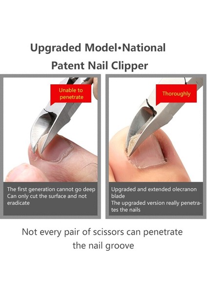 Tırnak Makası Ayak Tırnağı Kesiciler Pedikür Manikür Araçları Anti-Splash Batık Paronişi Profesyonel Düzeltme Aracı Ayak Ayak Tırnağı (Yurt Dışından) modelleri