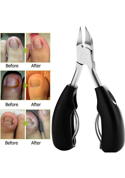 Kalın Batık Ayak Tırnakları Için Ayak Tırnak Makası Ağır Hizmet Tipi Hassas Tırnak Makası (Yurt Dışından) modelleri