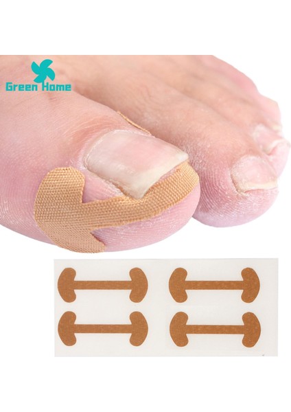 Yeşil Ev Pedikür Çıkartmaları Rahat Ayak Tırnağı Düzeltme Ayak Yaması (Yurt Dışından) fırsatları