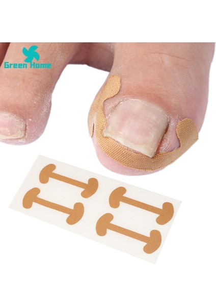 Yeşil Ev Pedikür Çıkartmaları Rahat Ayak Tırnağı Düzeltme Ayak Yaması (Yurt Dışından) indirimleri