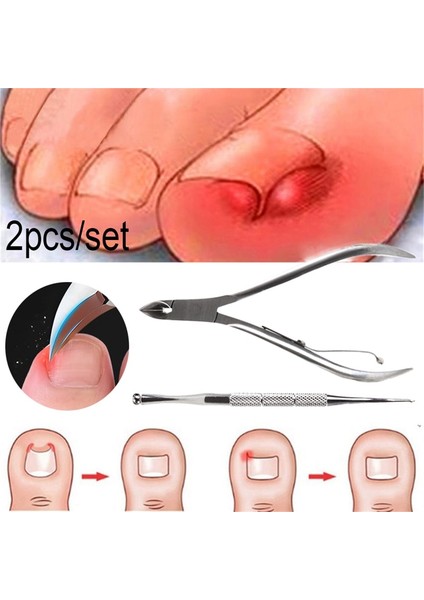 Adet Batık Parmak Ayak Tırnak Düzeltme Pense Tırnak Makası Kesiciler Ölü Cilt Kir Sökücü Paronişi Pediatri Pedikür Araçları (Yurt Dışından) indirimleri