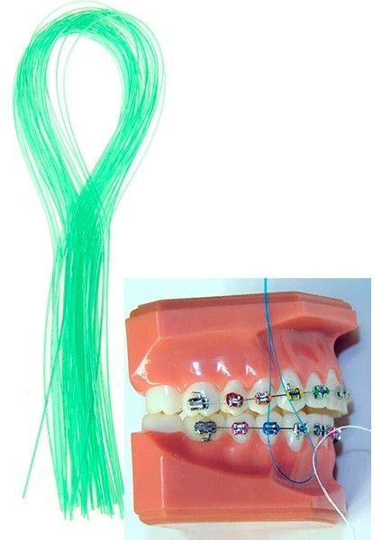 Lot Diş Ipi Geçirici Diş Çekiş Hattı Oral Taç Brace Köprü Implant Çember Diş Açma Parantez Çelik Çekiş (Yurt Dışından)